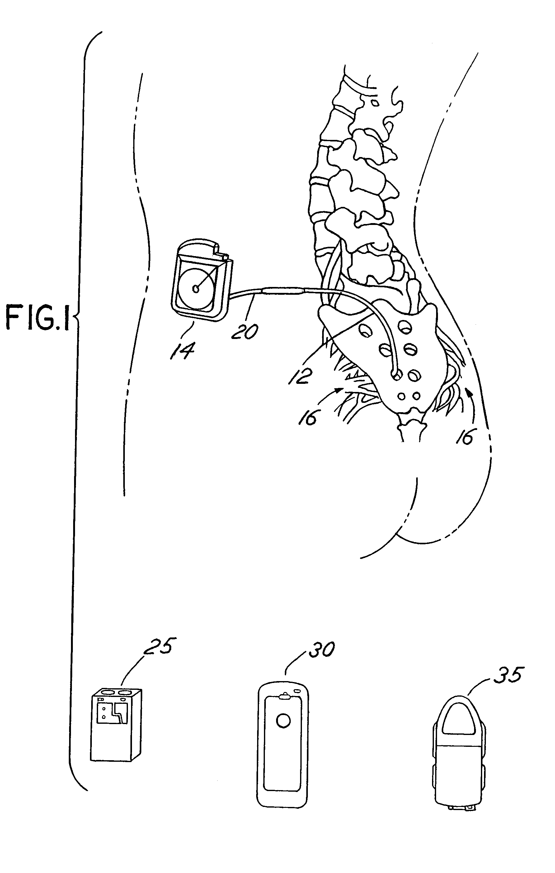 Automated impedance measurement of an implantable medical device