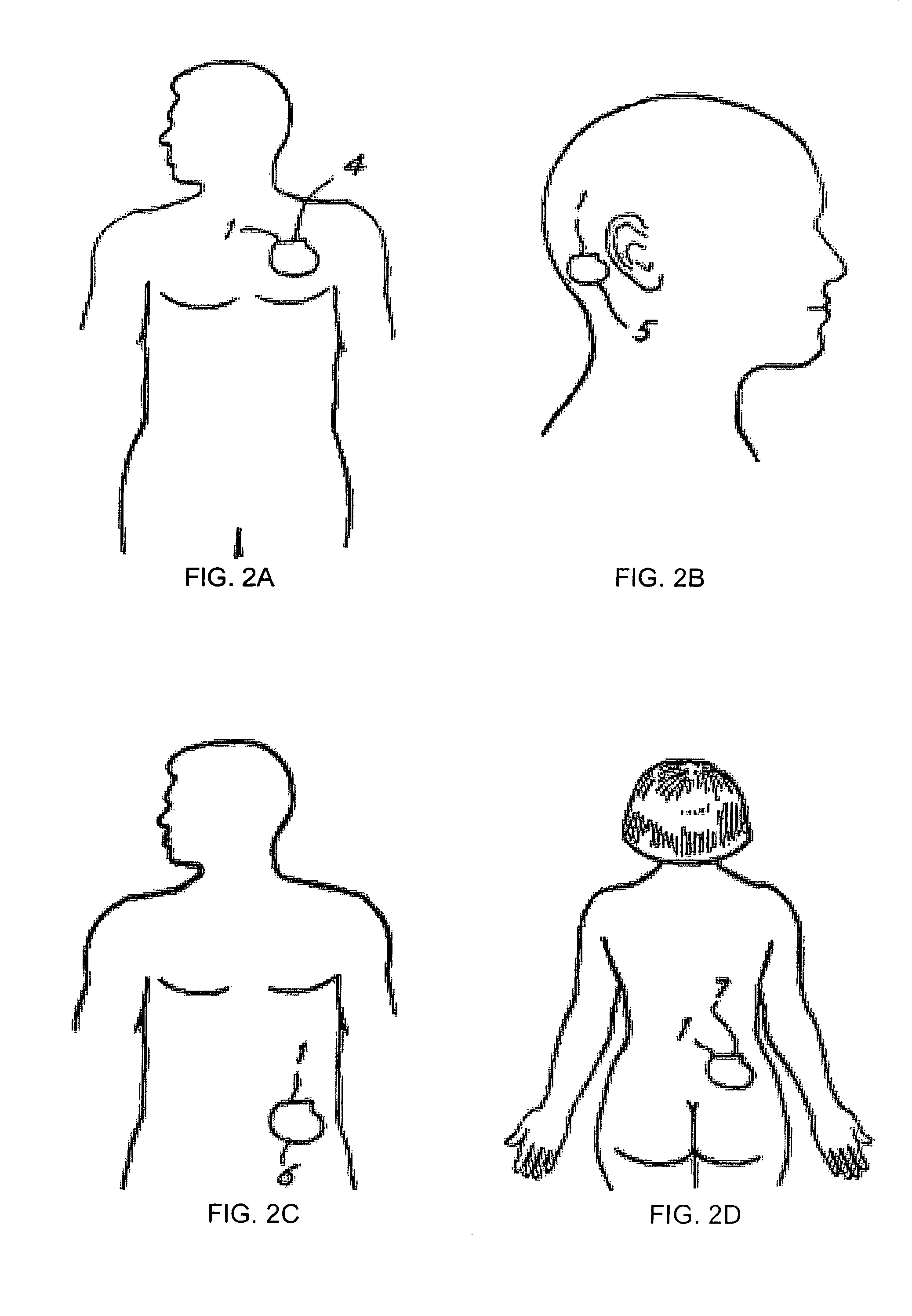 Automated impedance measurement of an implantable medical device