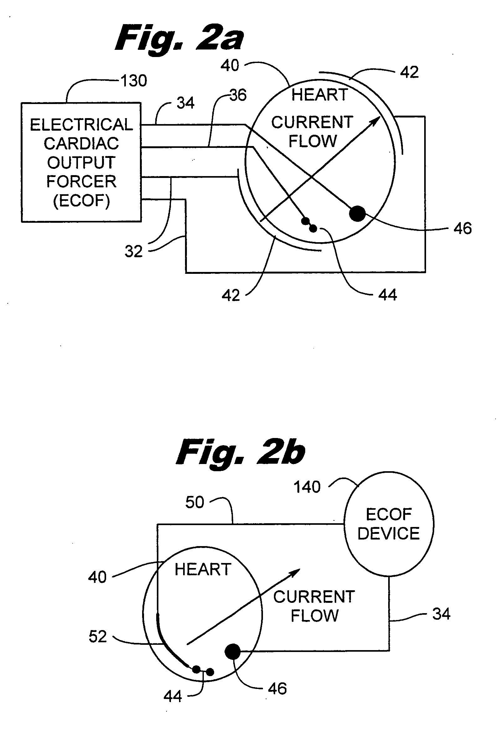 Electrical cardiac output forcer