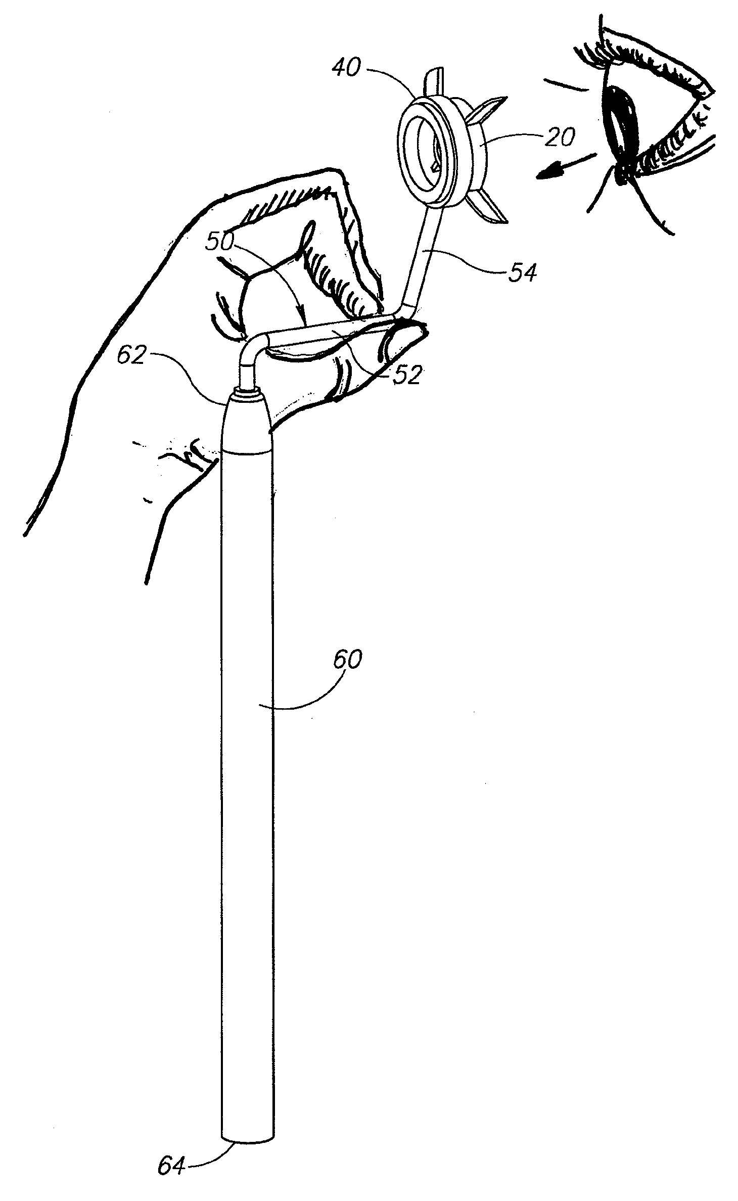 System and method for corneal astigmatic axis marking