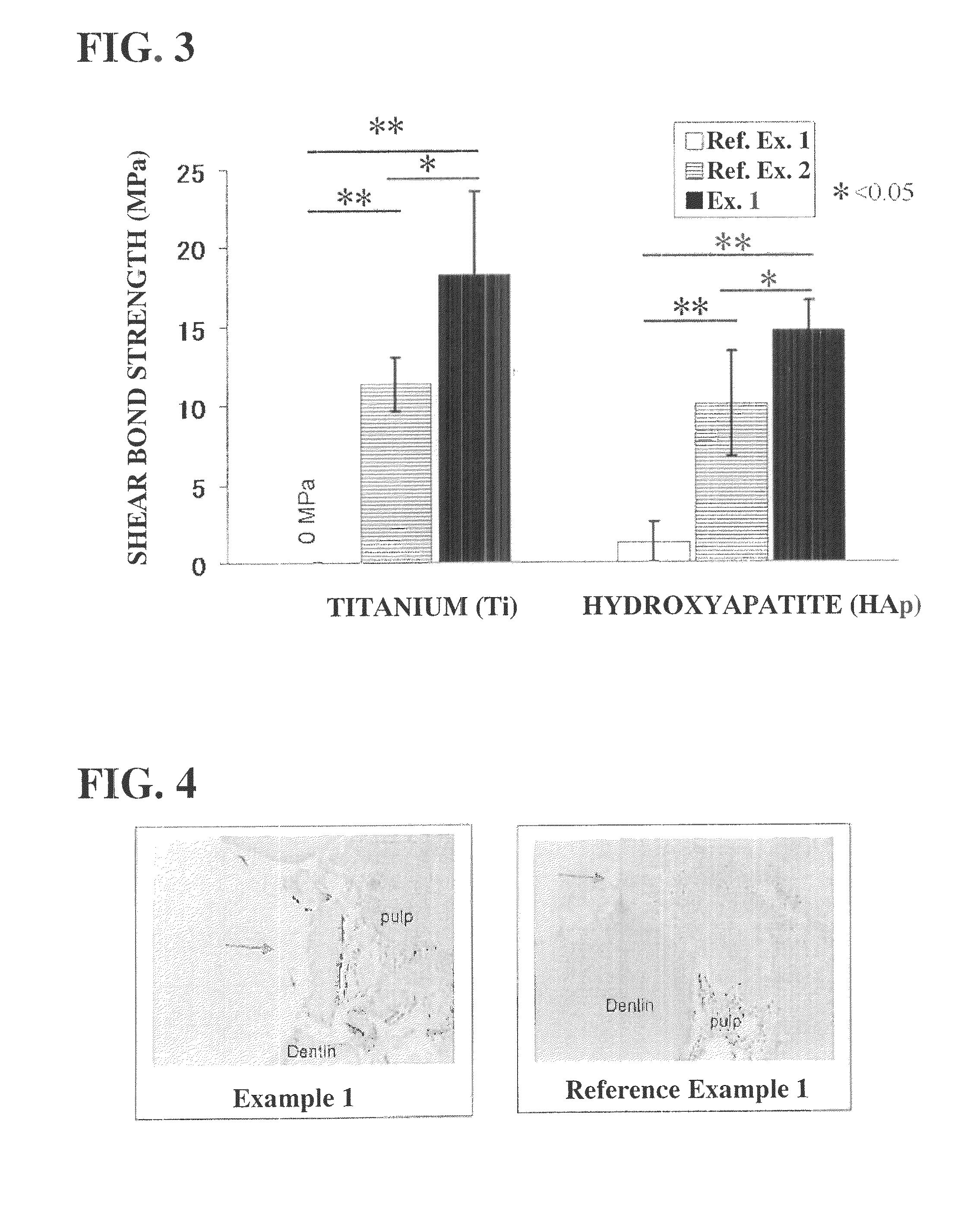 Kit for adhering biological hard tissues