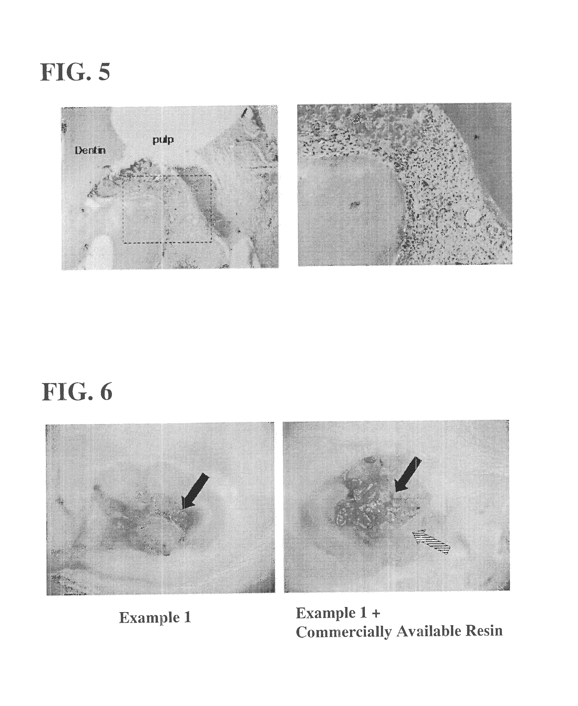 Kit for adhering biological hard tissues