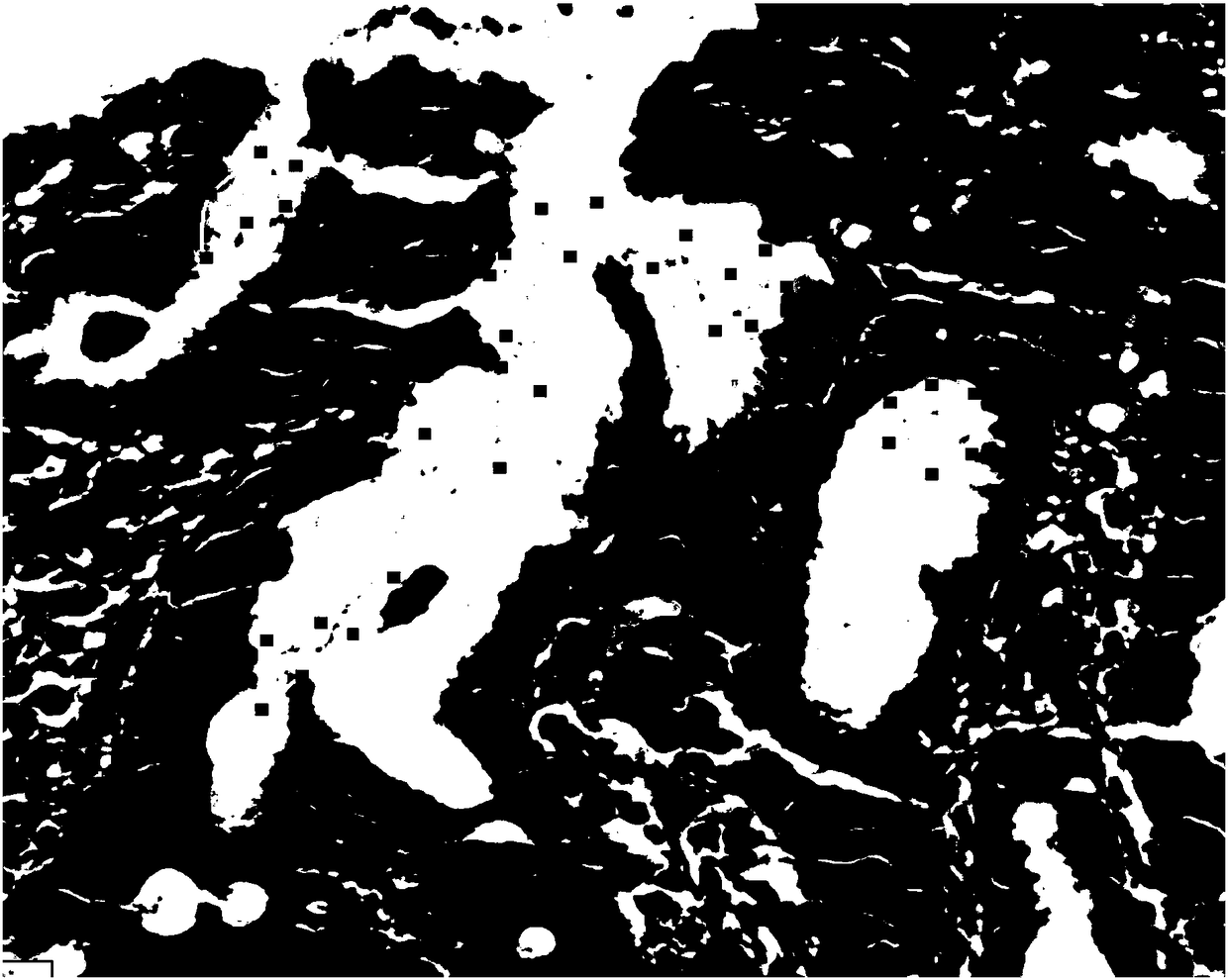 Stomach helicobacter pylori infection pathological diagnosis support system and method