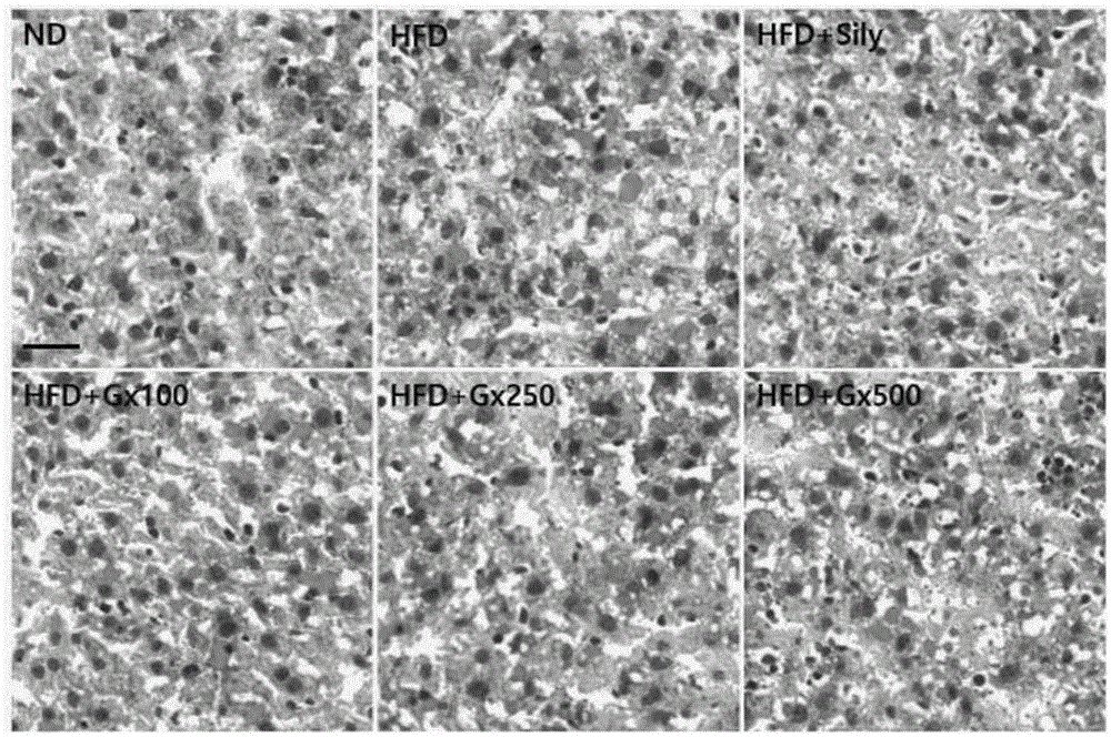 Pharmaceutical composition and health functional food containing red ginseng concentrate having enhanced compound K for preventing and treating non-alcoholic fatty liver disease