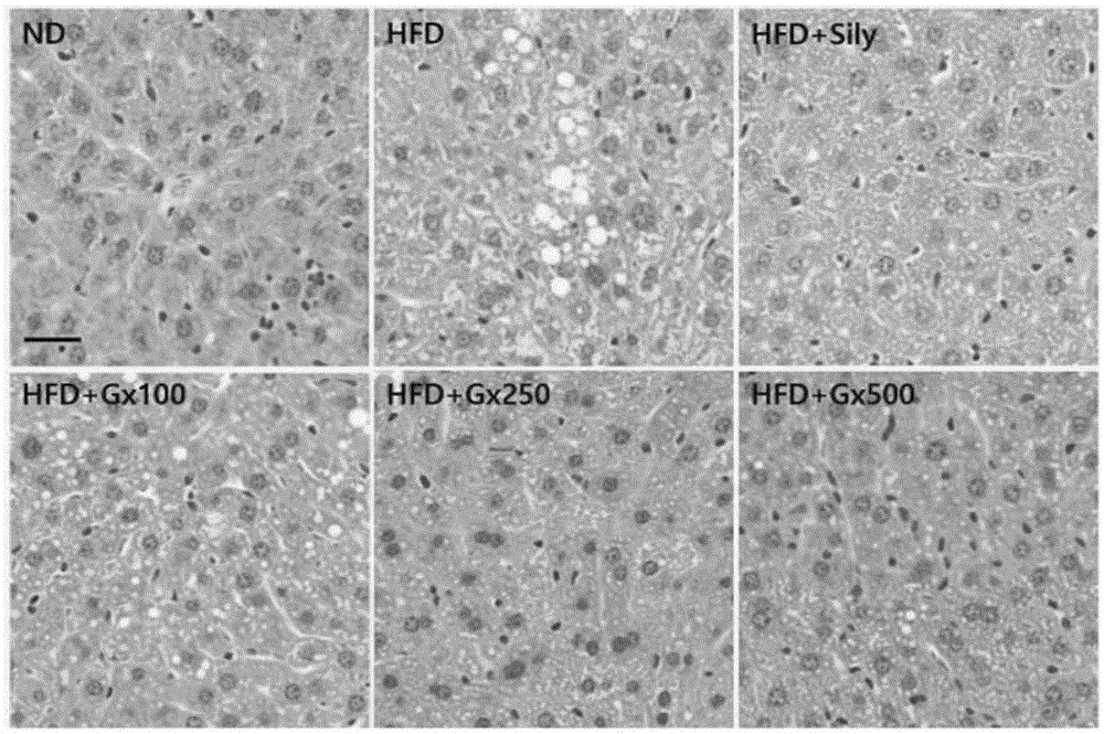 Pharmaceutical composition and health functional food containing red ginseng concentrate having enhanced compound K for preventing and treating non-alcoholic fatty liver disease