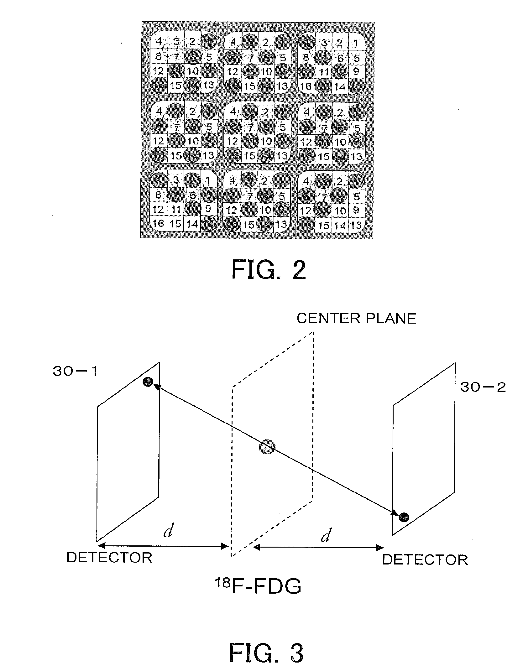 Radiation therapy apparatus