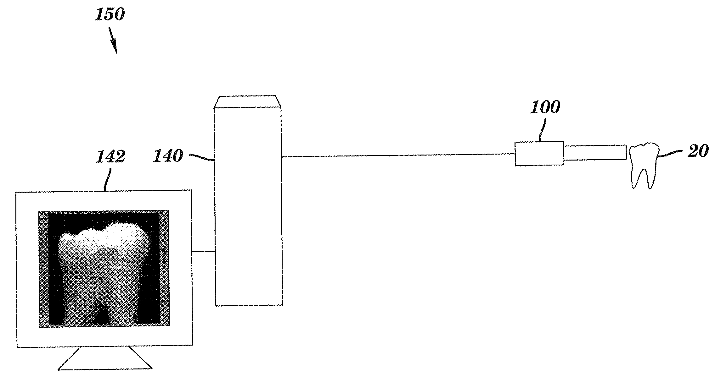 Intra-oral camera for diagnostic and cosmetic imaging