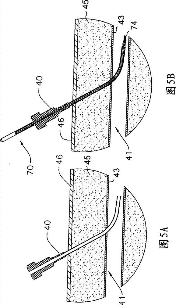 Drug eluting vascular closure devices and methods