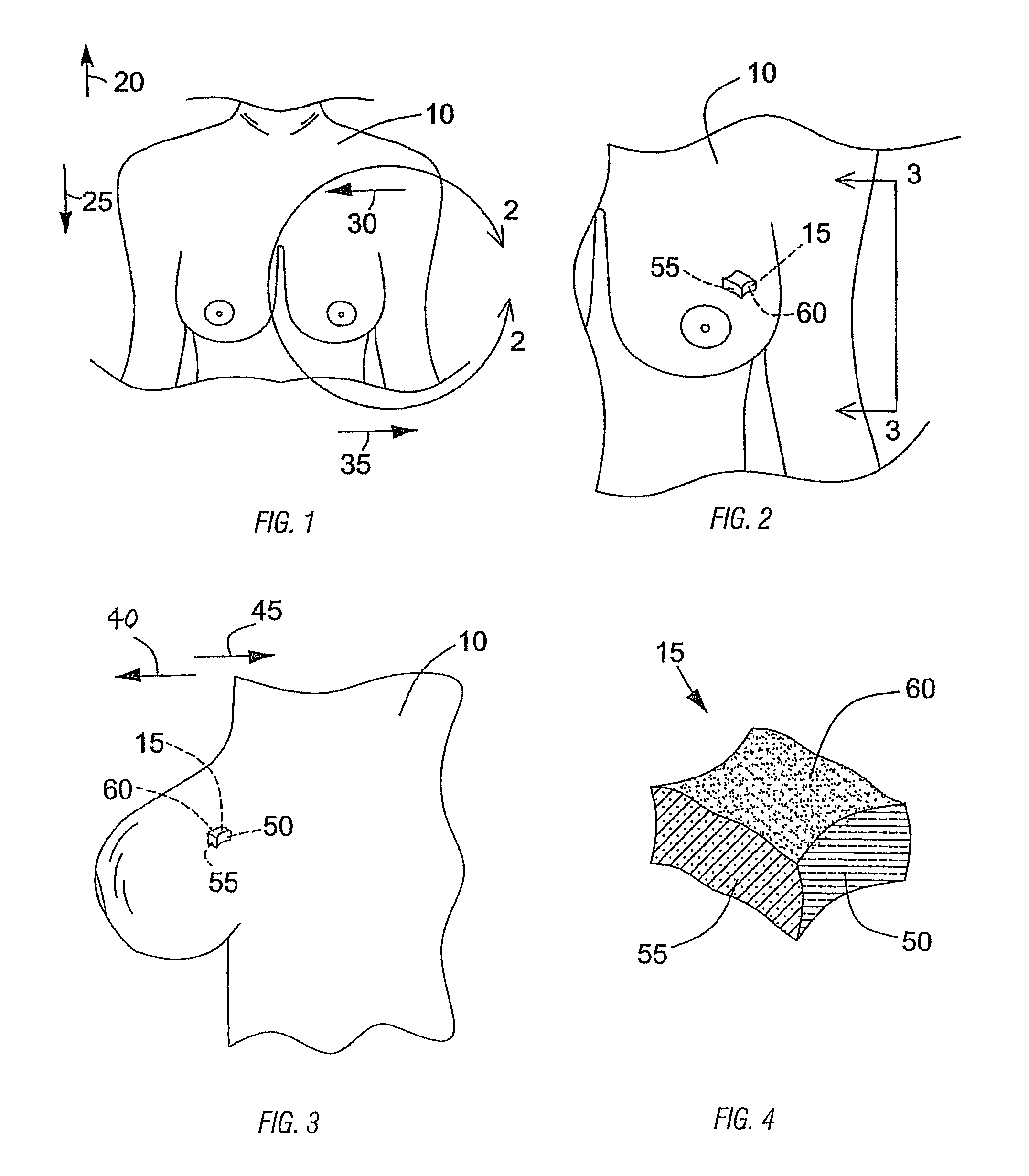 Method of identifying the orientation of a tissue sample