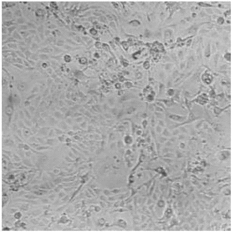 Feeder cell processing method applied to conditional reprogramming technology