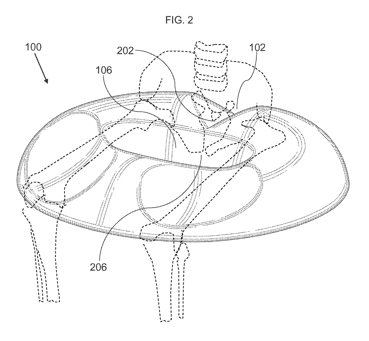 Toroidal seating cushion