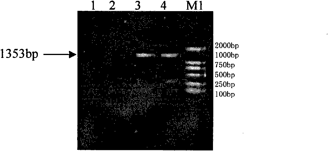 Construction of lactobacillus acidophilus S-layer protein surface display system