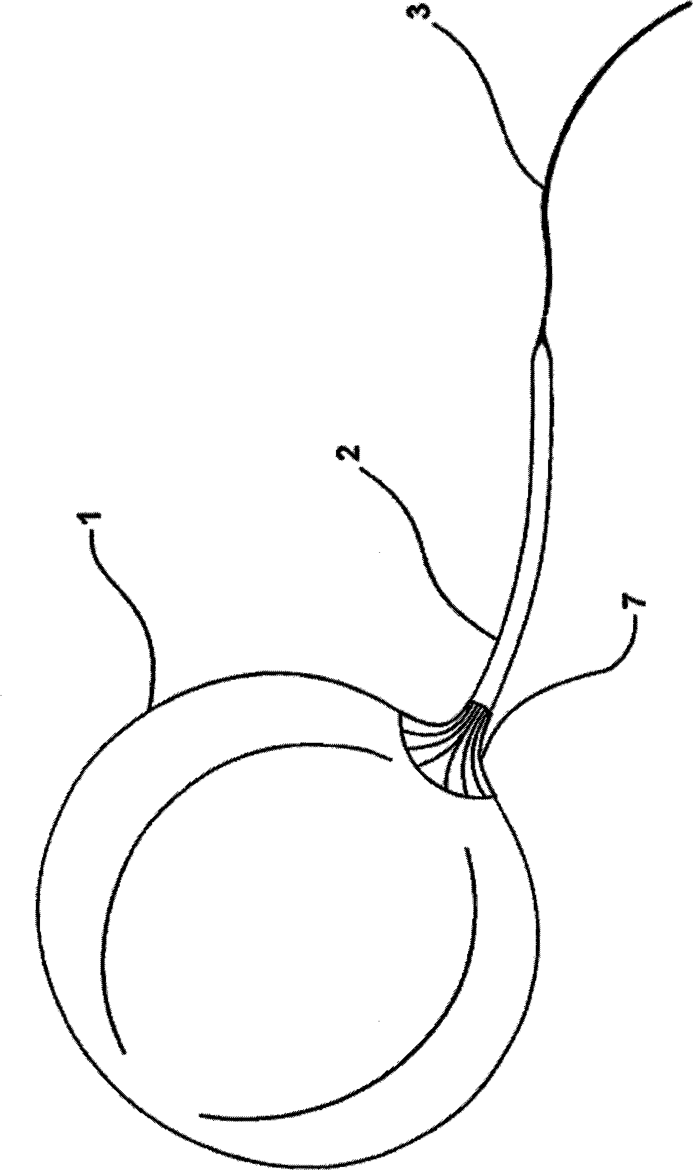 Intragastric balloon assembly