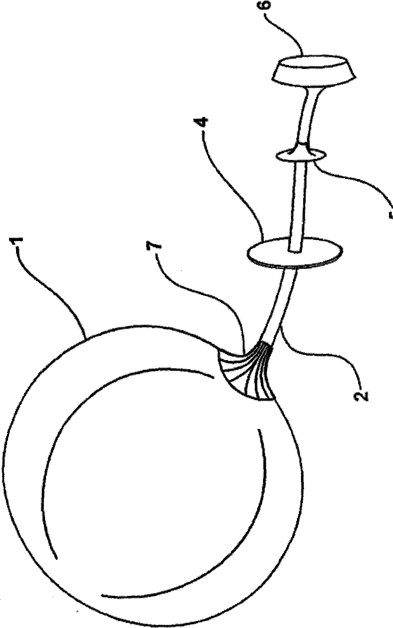 Intragastric balloon assembly