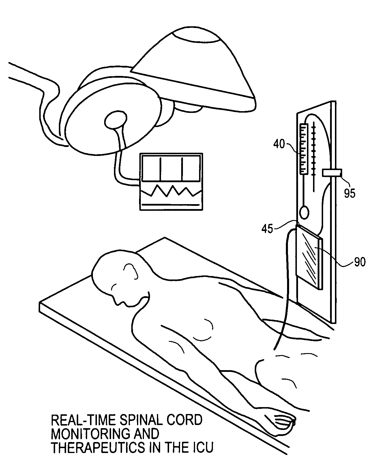 System and method for monitoring and delivering therapeutics to the spinal cord