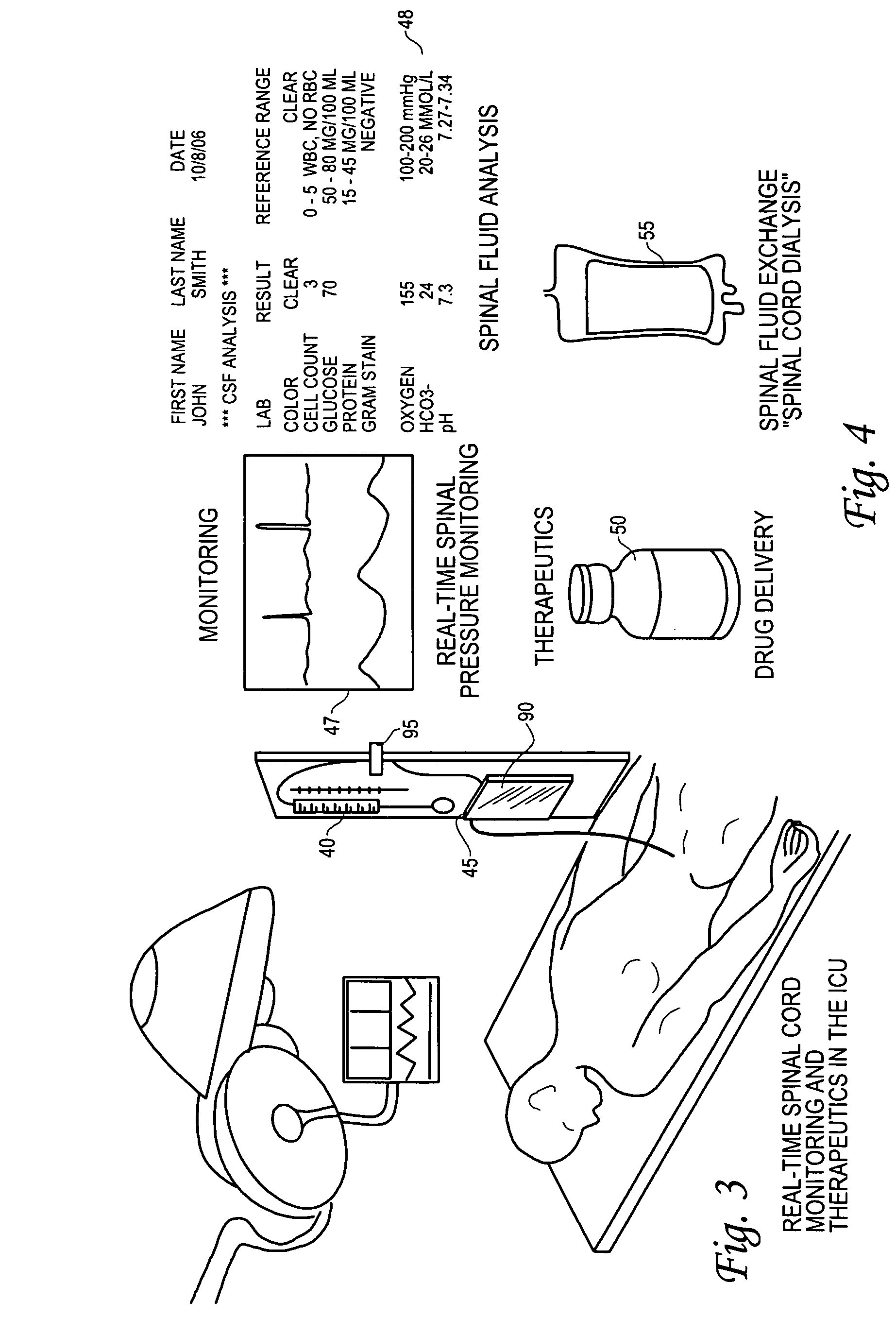 System and method for monitoring and delivering therapeutics to the spinal cord