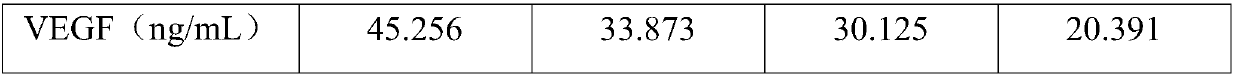 Umbilical cord mesenchymal stem cell factor freeze-dried powder and preparation method thereof