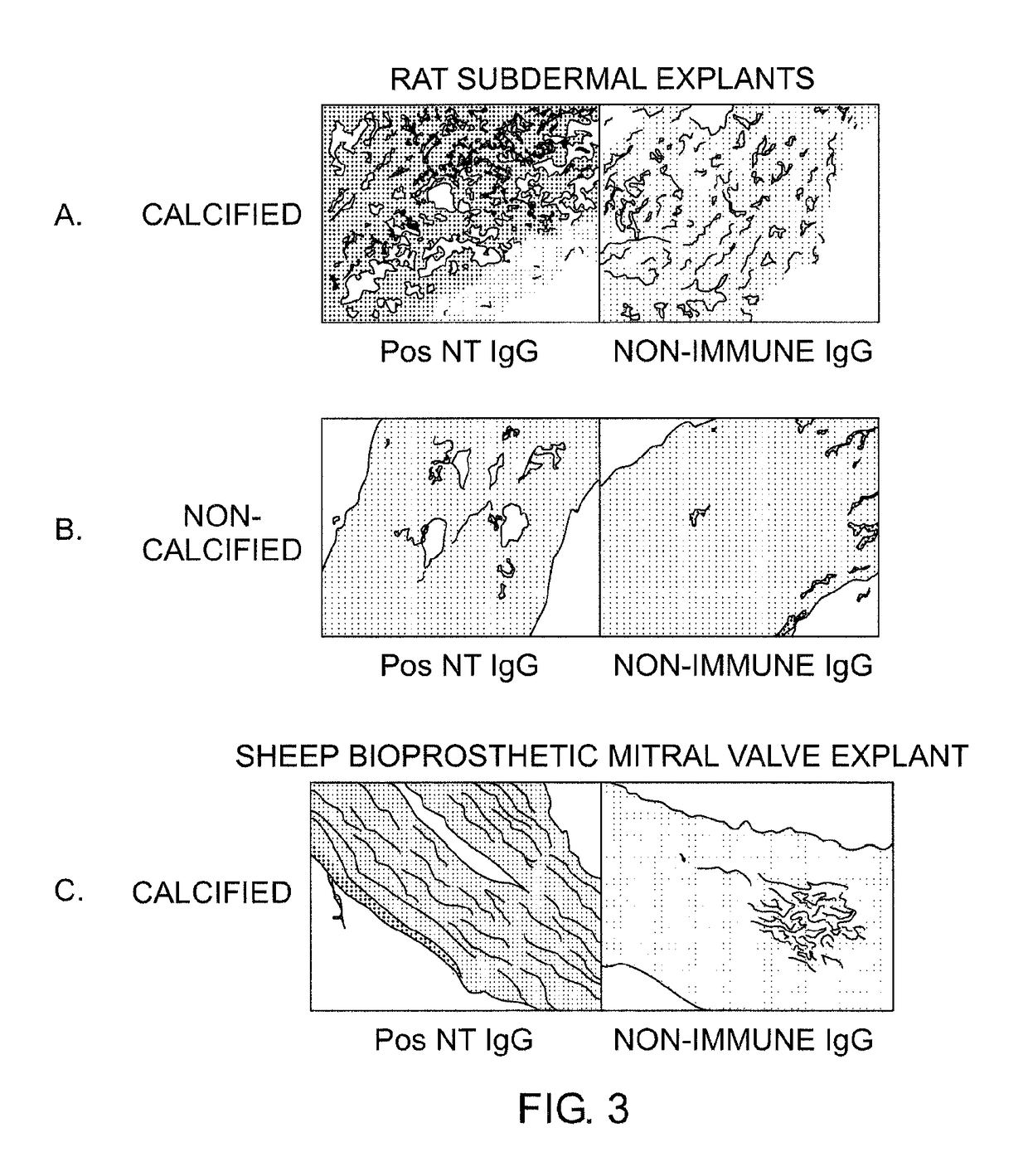 Oxidation resistant bioprosthetic tissues and preparation thereof