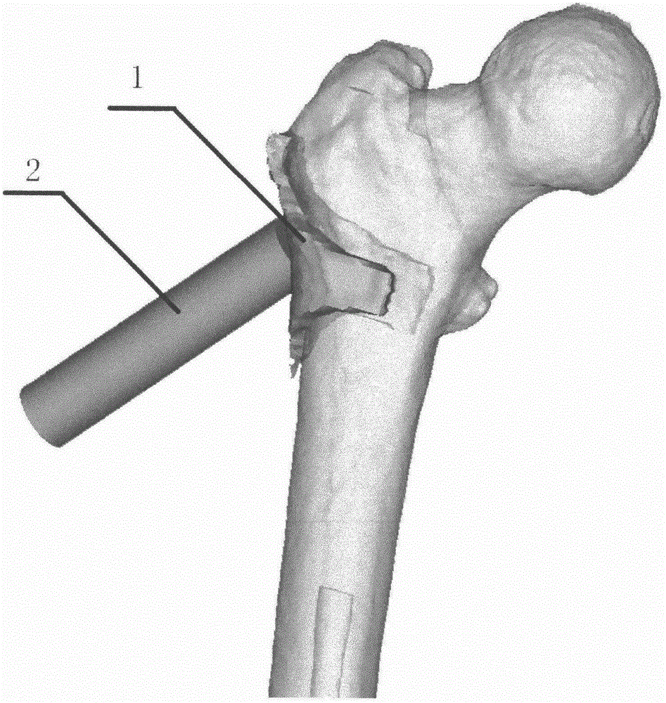 Medullary core three-dimensional decompressing device for treating avascular necrosis of femoral head as well as preparing and testing methods based on medullary core three-dimensional decompressing device