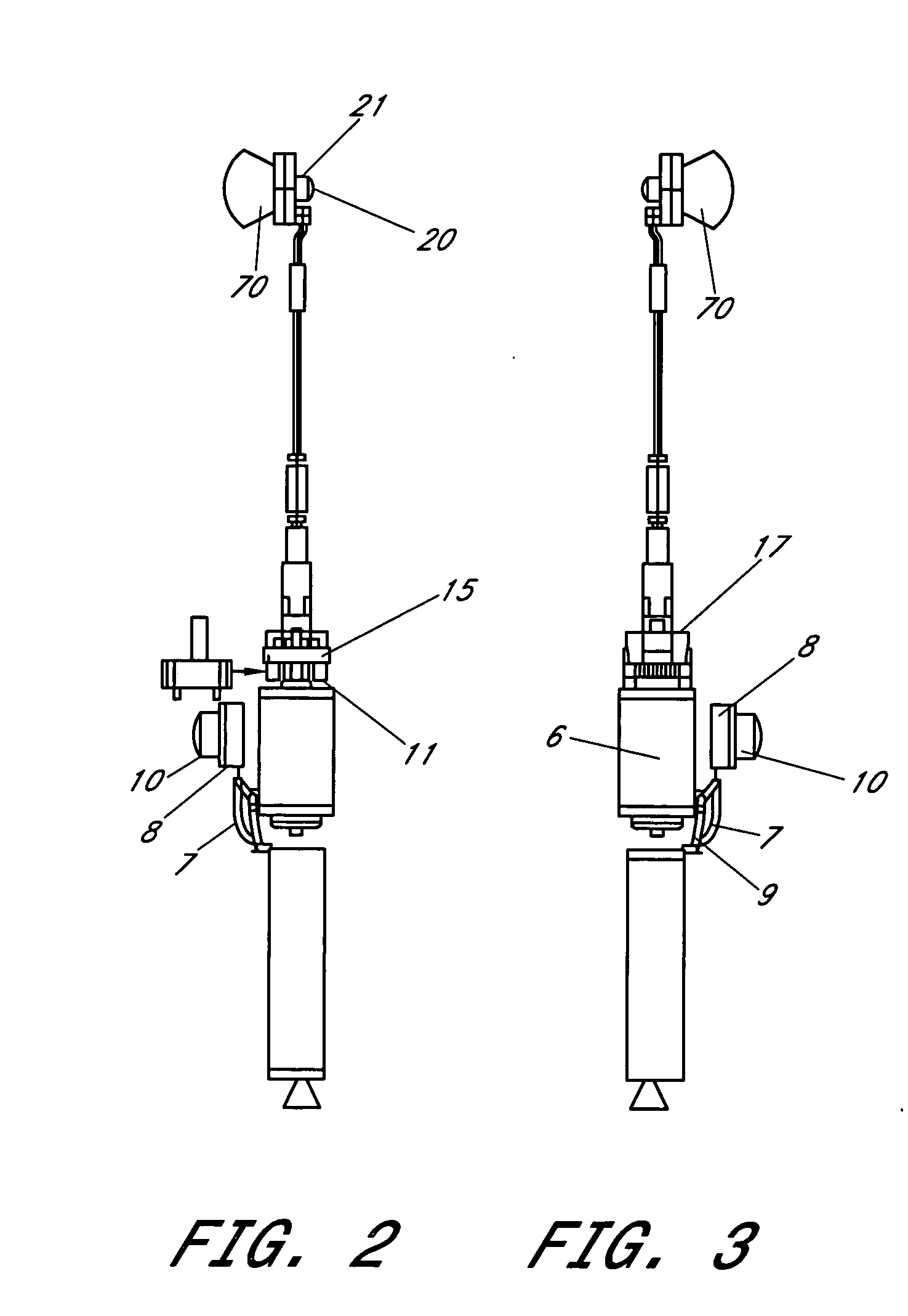 Dental stain remover