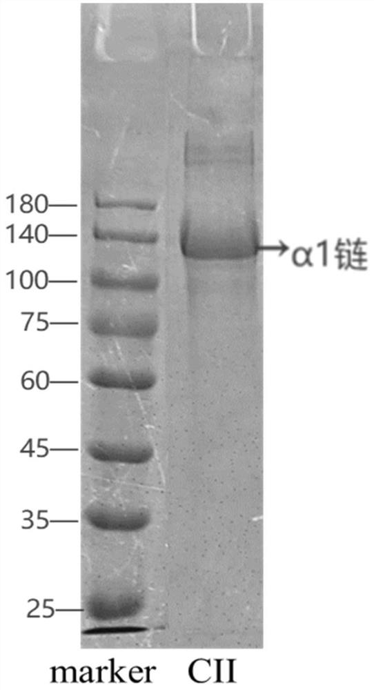 Soluble non-denatured II-type collagen and preparation method thereof