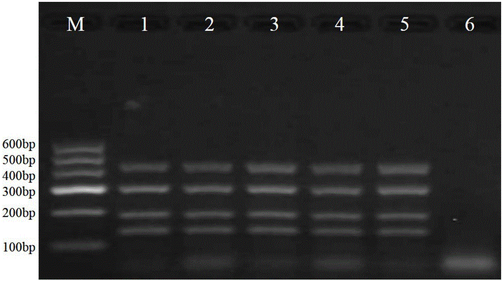 Method for amplifying four genes of Botrytis cinerea and multiplex PCR (polymerase chain reaction) primer set thereof