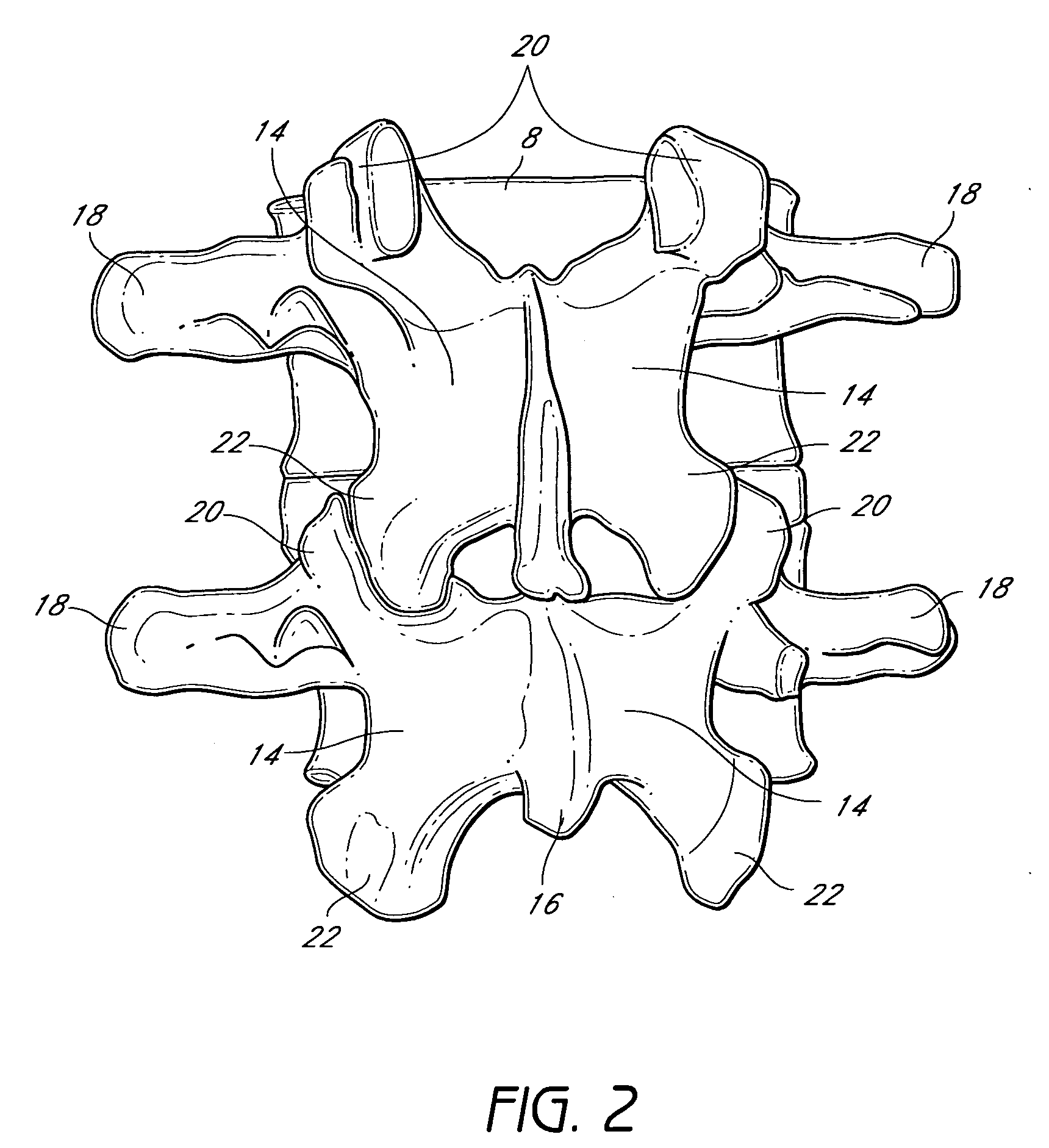 System and method for protecting neurovascular structures