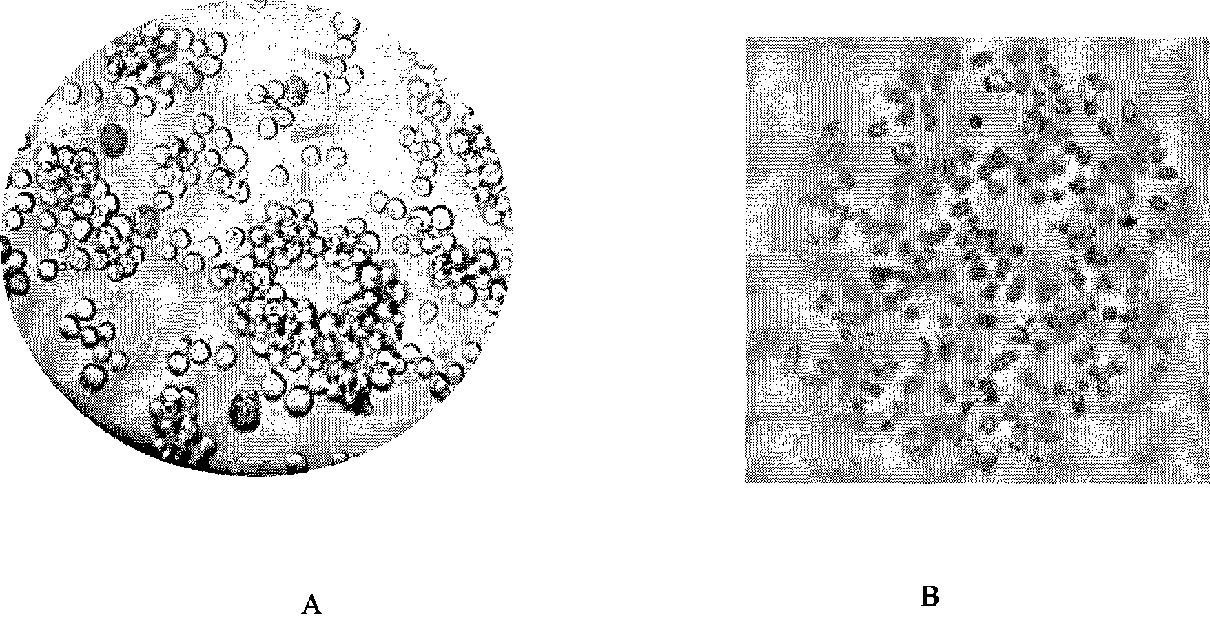 Anti-double-chain DNA monoclone antibody with antineoplastic activity and preparation method thereof