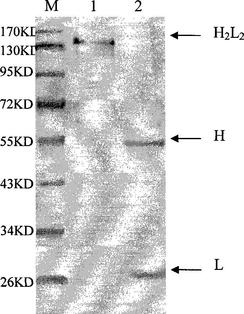 Anti-double-chain DNA monoclone antibody with antineoplastic activity and preparation method thereof