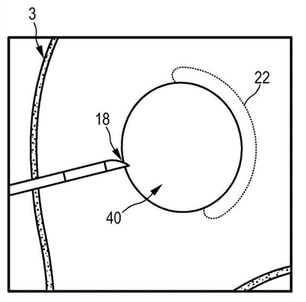 Temperature distribution determining apparatus