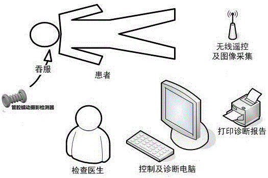 A lumen peristalsis photography detector and detection device