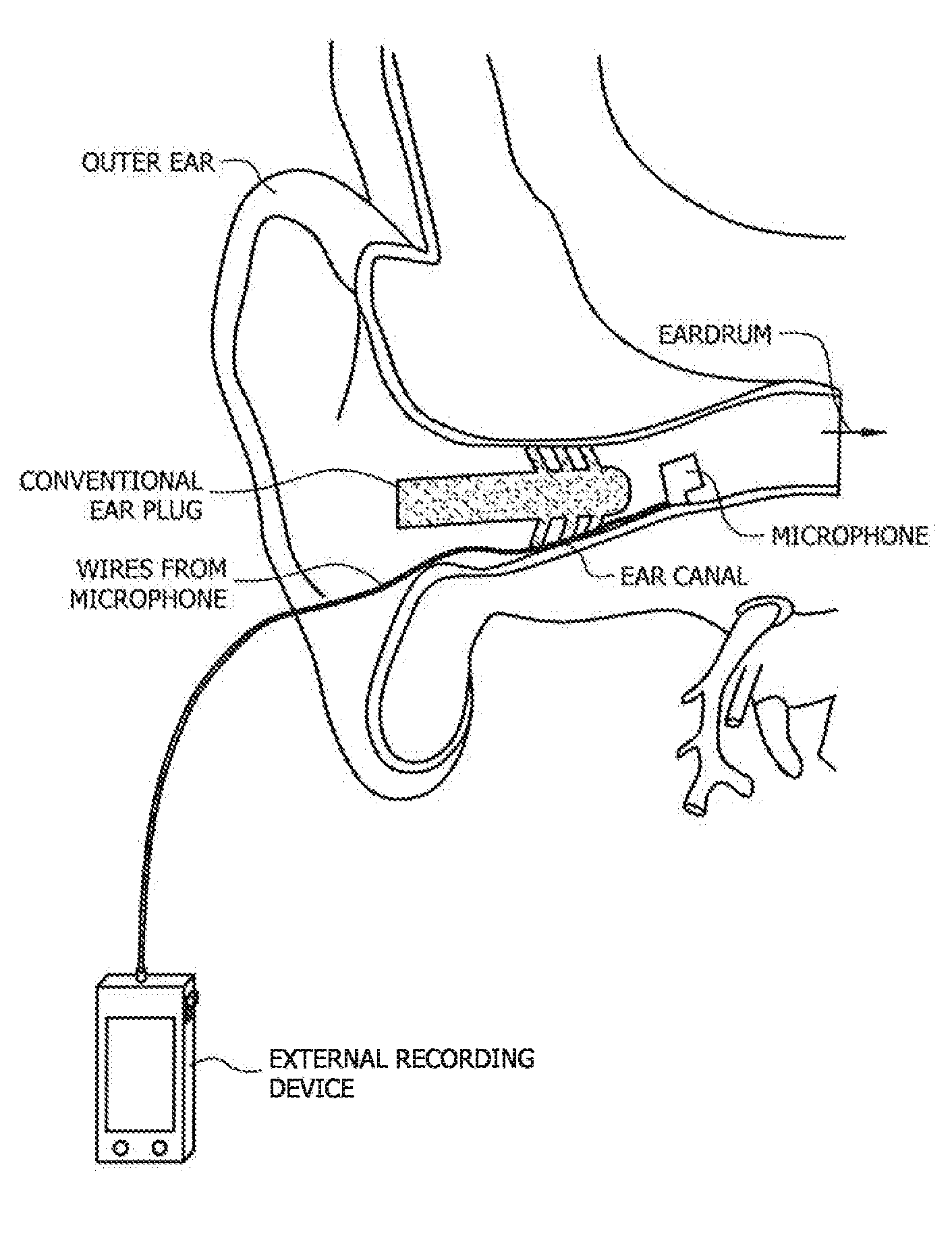 Methods and Apparatus for Continuous Noise Exposure Monitoring