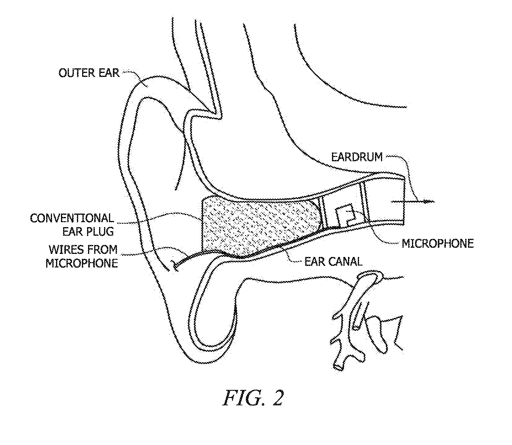 Methods and Apparatus for Continuous Noise Exposure Monitoring