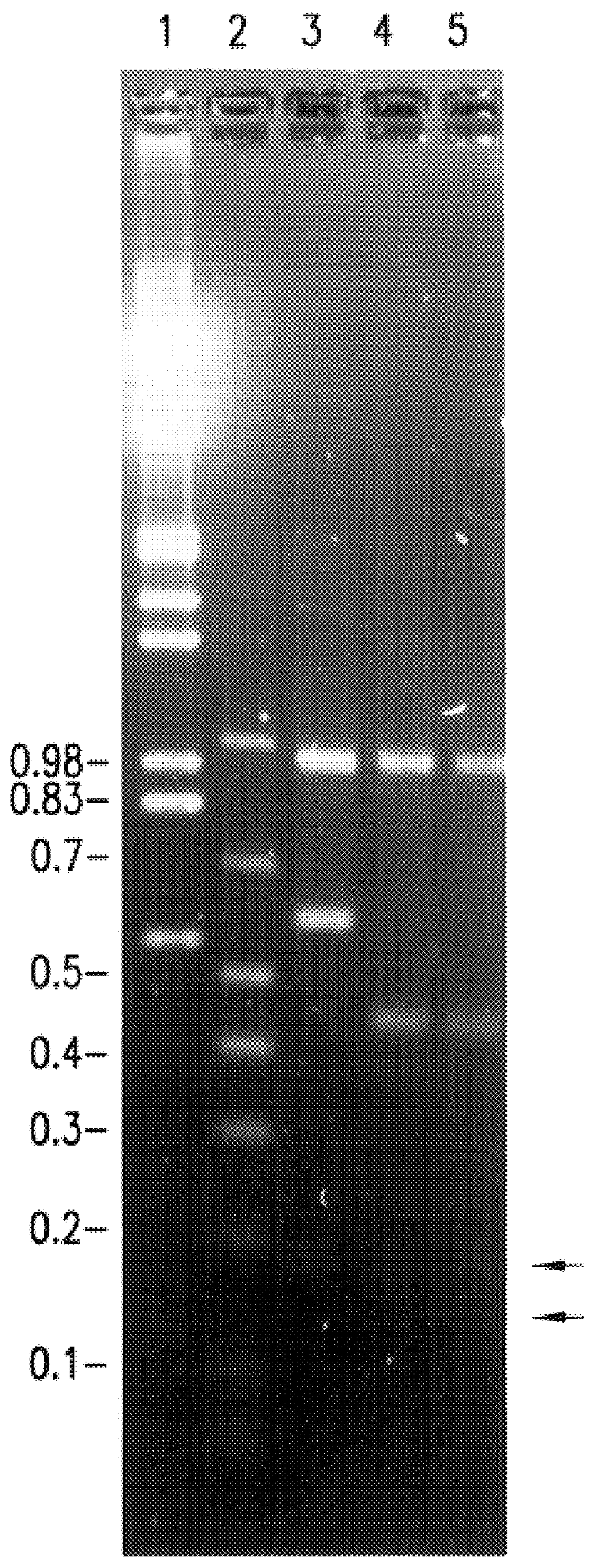 Differentiation of avian infectious bronchitis virus serotypes