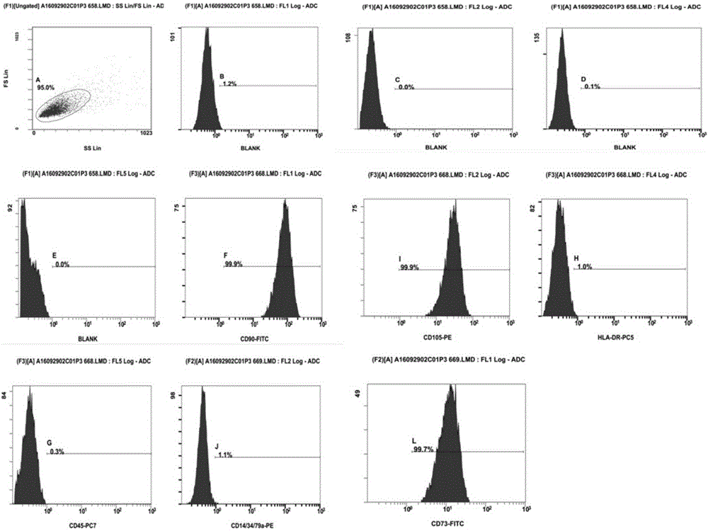 Human-derived adipose tissue-derived stem cell factor, preparation method and application thereof