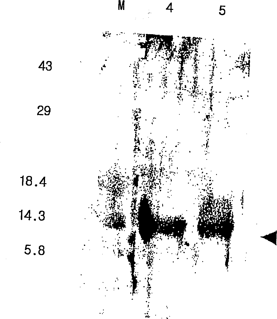 Immunoassay and diagnostic reagent for malaria