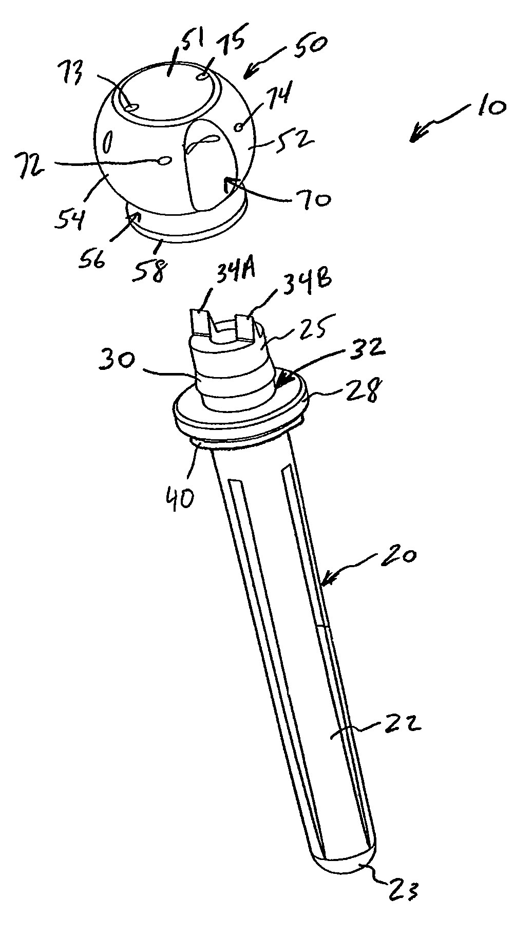 Ulnar head prosthesis system