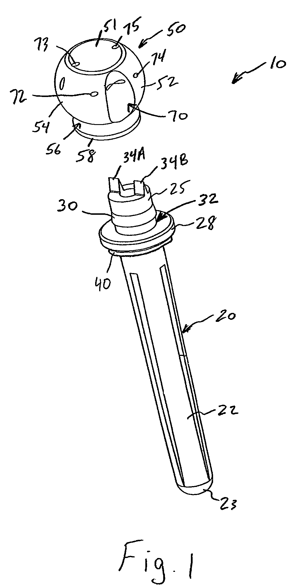 Ulnar head prosthesis system