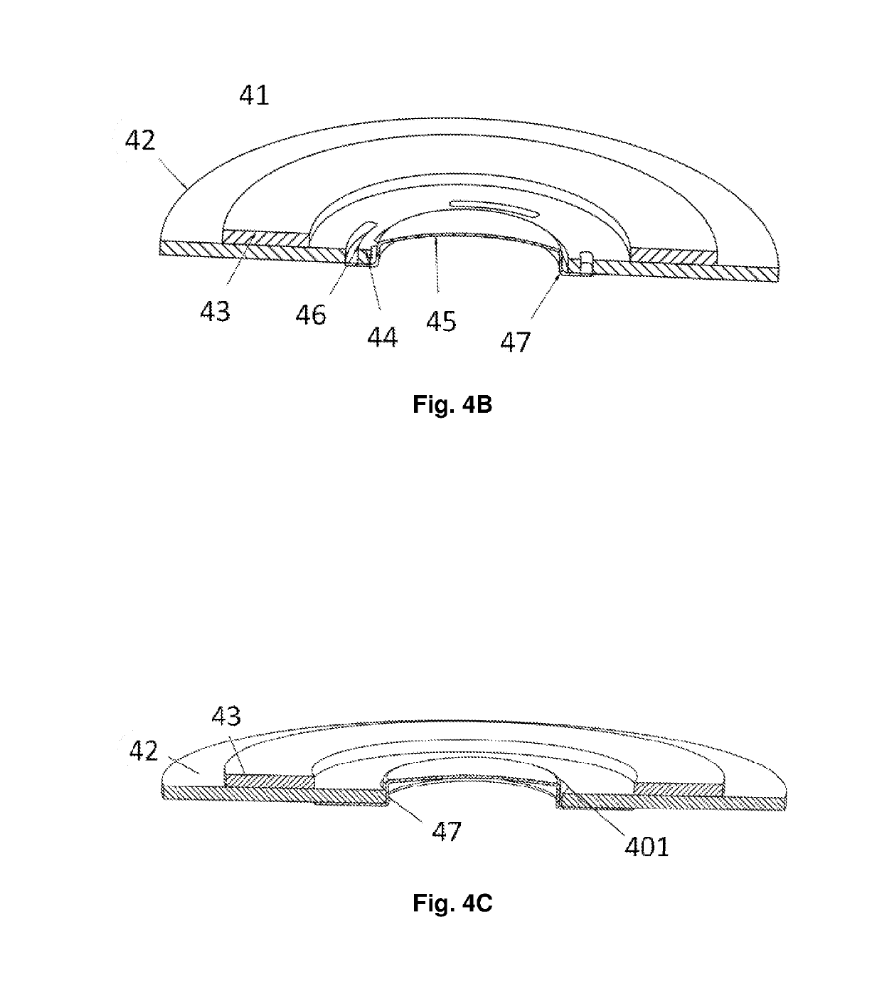 Separable Membrane Improvements