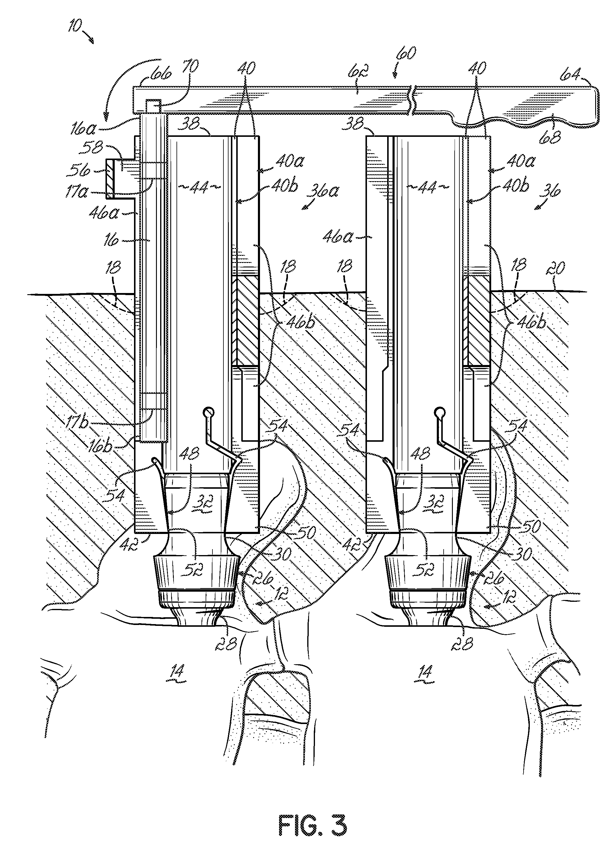 Instrumentation and associated techniques for minimally invasive vertebral rod installation