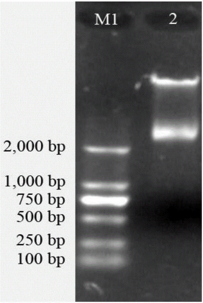 Gene capable of improving quality of plant fruit amylopectin, encoding product and application of gene