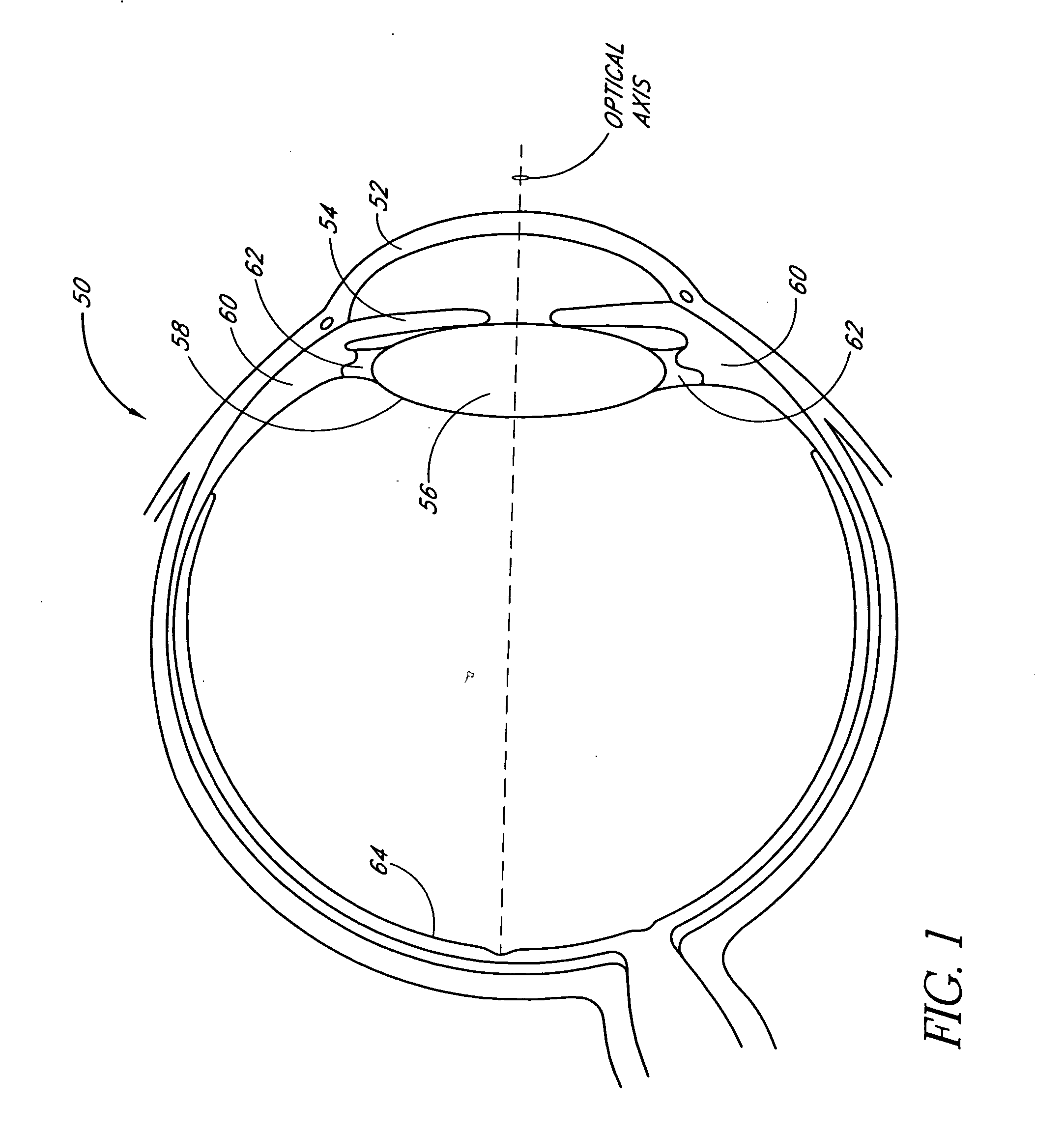 Single-piece accommodating intraocular lens system