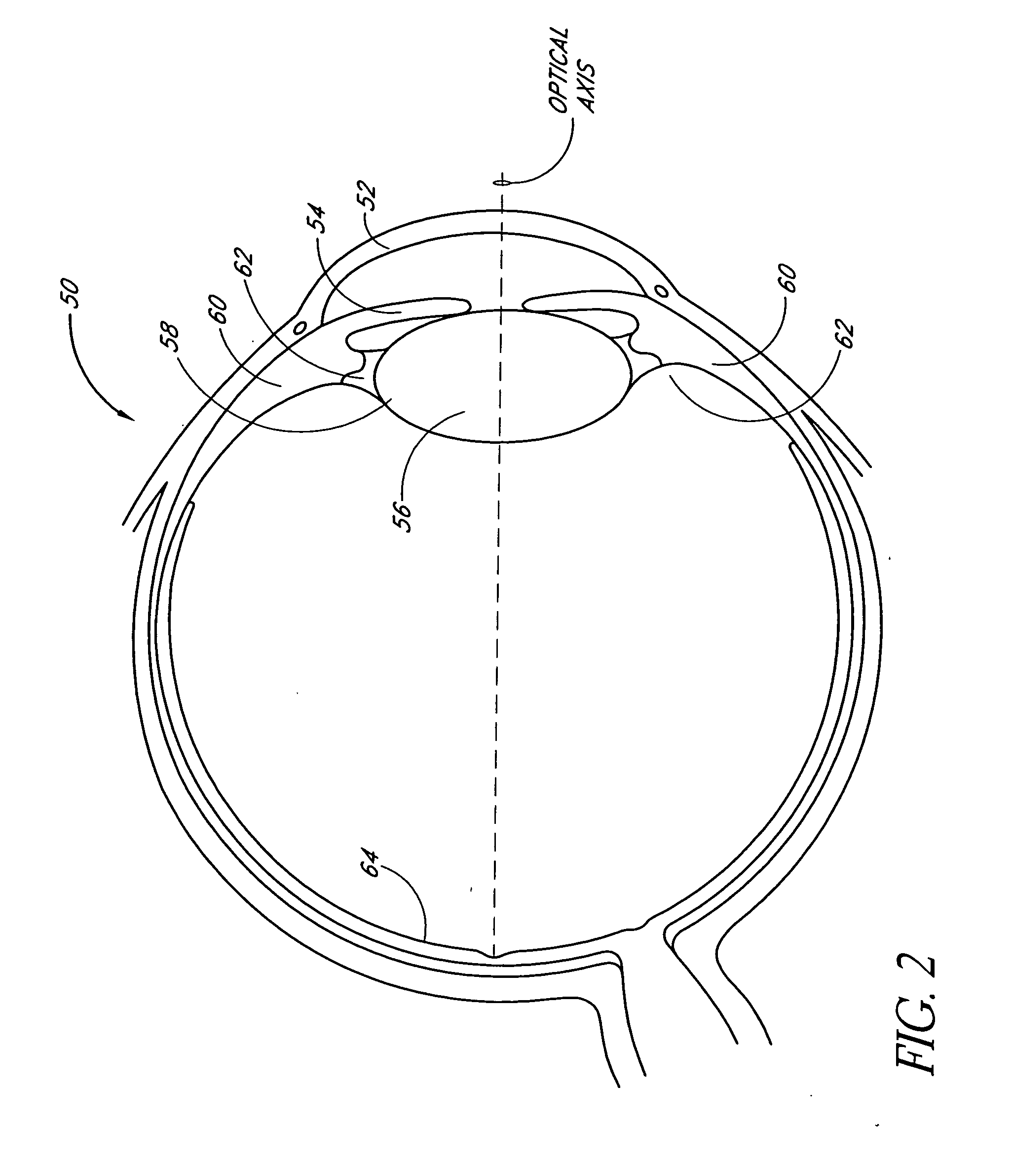 Single-piece accommodating intraocular lens system