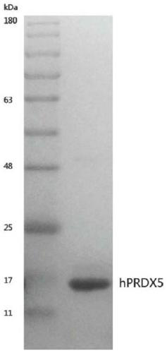 Host factor hPRDX5 with anti-tumor effect, encoding gene and application of host factor