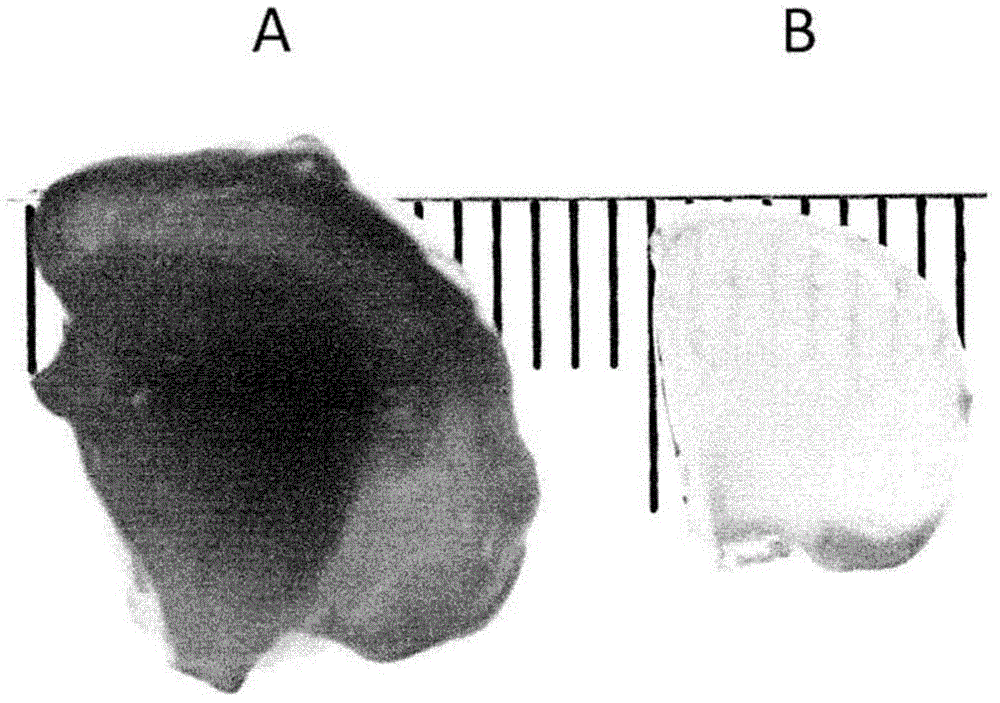 Method for rendering tissue transparent, reagent for rendering tissue transparent, and tissue observation method