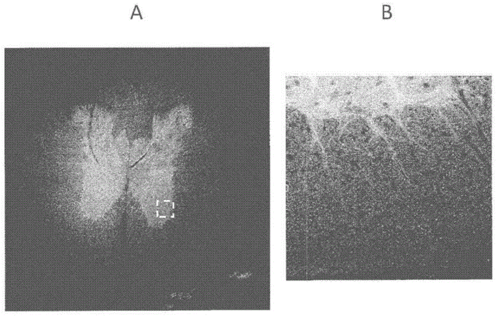 Method for rendering tissue transparent, reagent for rendering tissue transparent, and tissue observation method