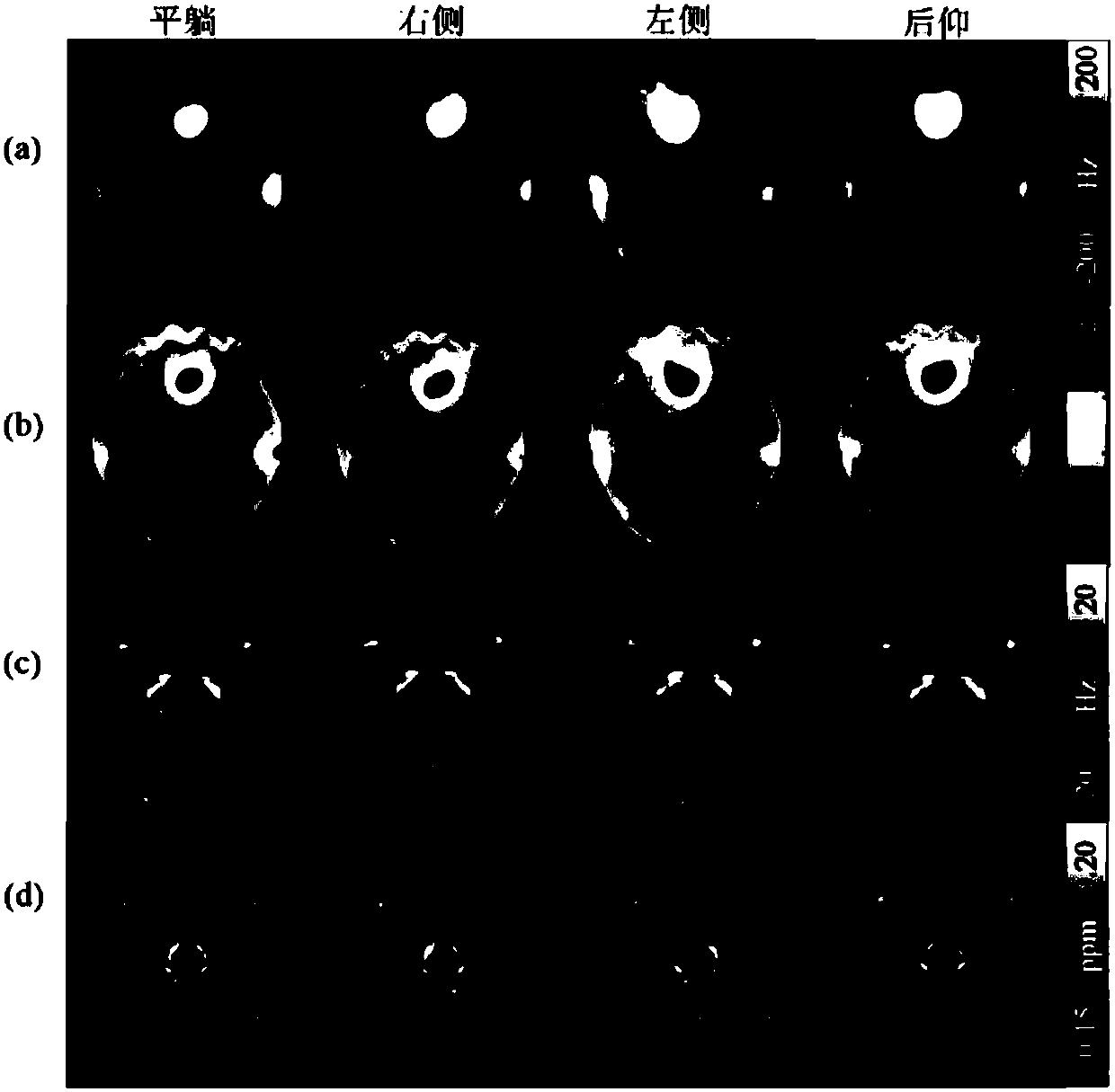 Local field estimation method based on magnetic resonance dipole field space distribution