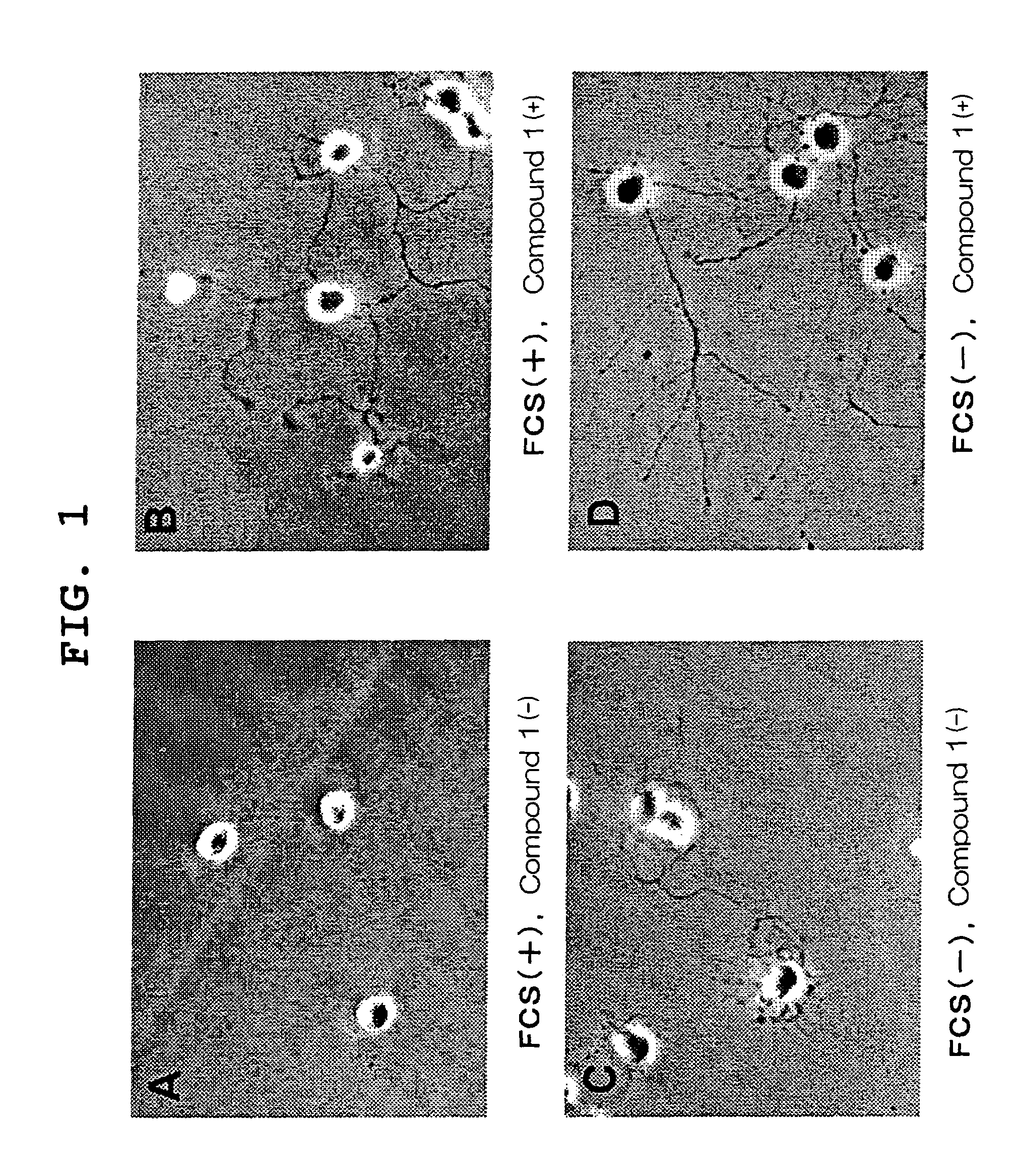 Visual function disorder improving agents