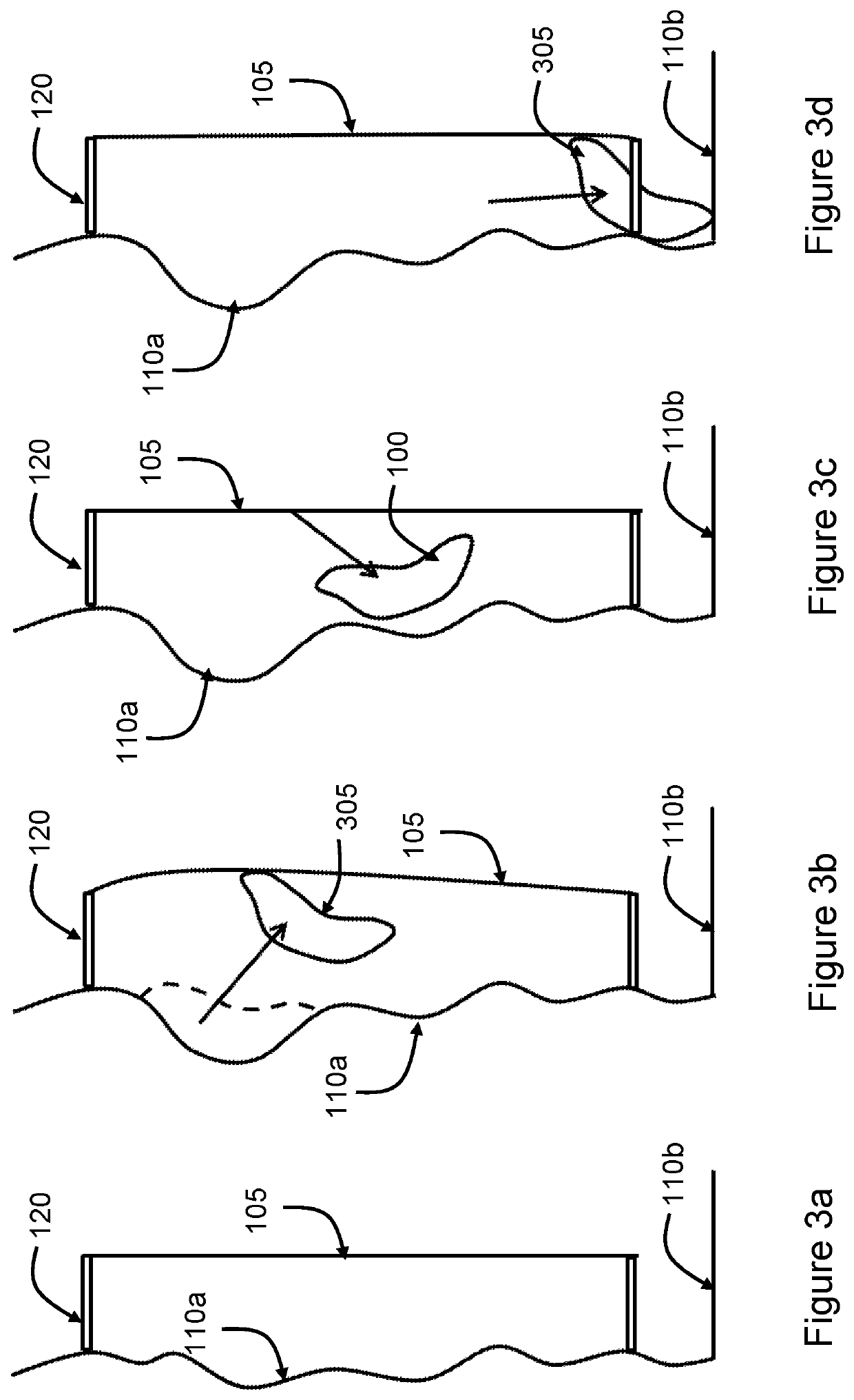 Rib, wall, slope and roof safety system