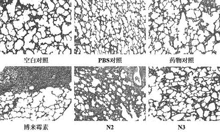 Application of polypeptide and polypeptide derivative in prevention and treatment of fibrotic diseases